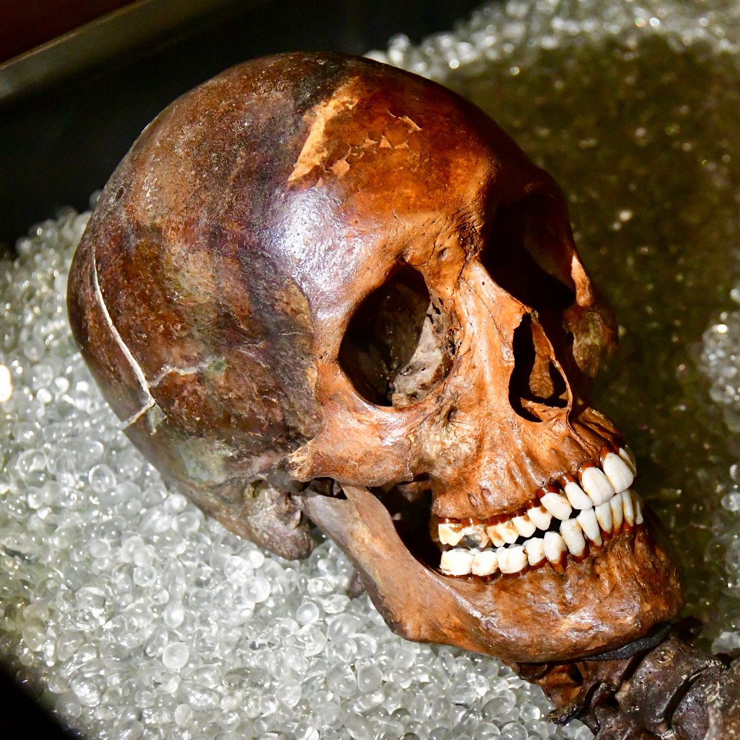 Robert Kennicott Skull
