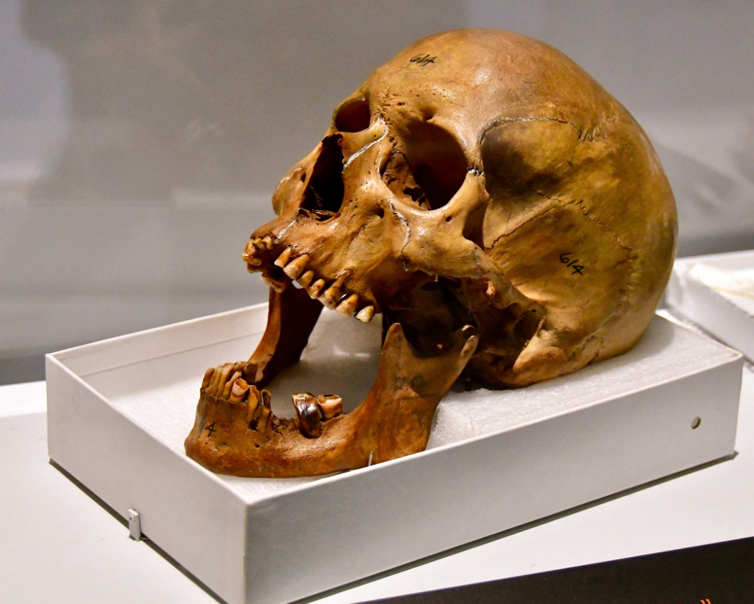 Male Human Skull